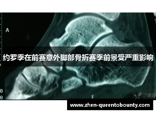 约罗季在前赛意外脚部骨折赛季前景受严重影响